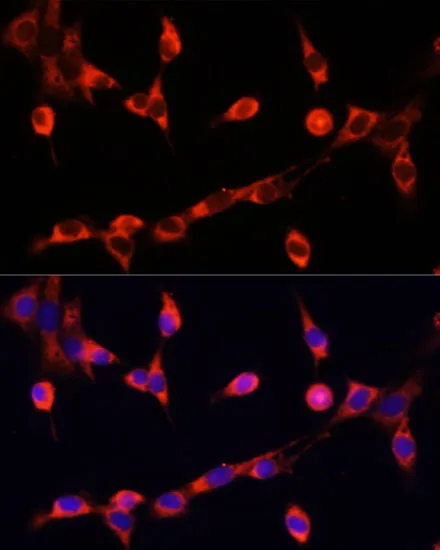 CHAT Polyclonal Antibody - image 1