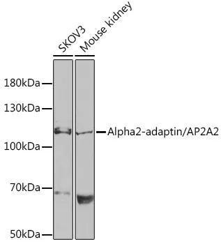 AP2A2 Polyclonal Antibody - image 1