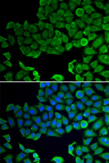 VPS4A Polyclonal Antibody - image 1