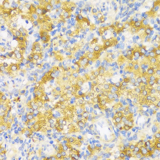 HLA-DPB1 Polyclonal Antibody - image 1