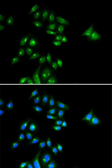 PHC3 Polyclonal Antibody - image 1