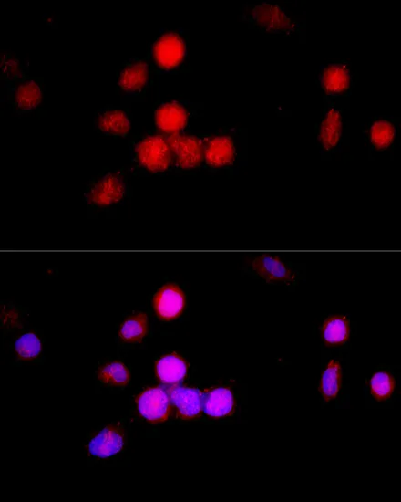 CCNA2 Polyclonal Antibody - image 1