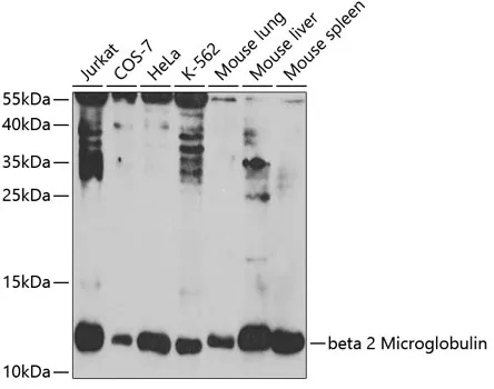 beta 2 Microglobulin Polyclonal Antibody - image 1