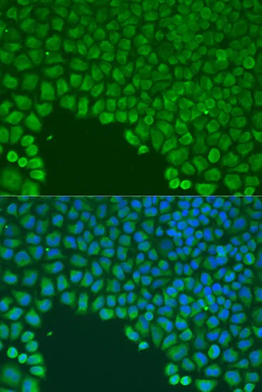 CDC42 Polyclonal Antibody - image 1