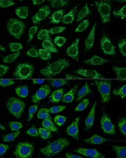NDUFA4 Polyclonal Antibody - image 1