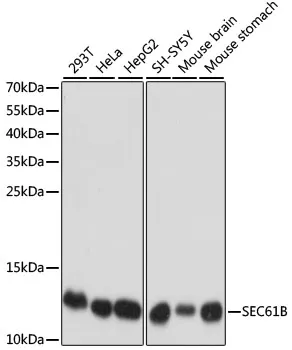 (KO Validated) SEC61B Polyclonal Antibody - image 1