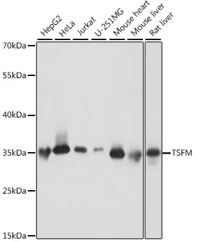 TSFM Polyclonal Antibody - image 1