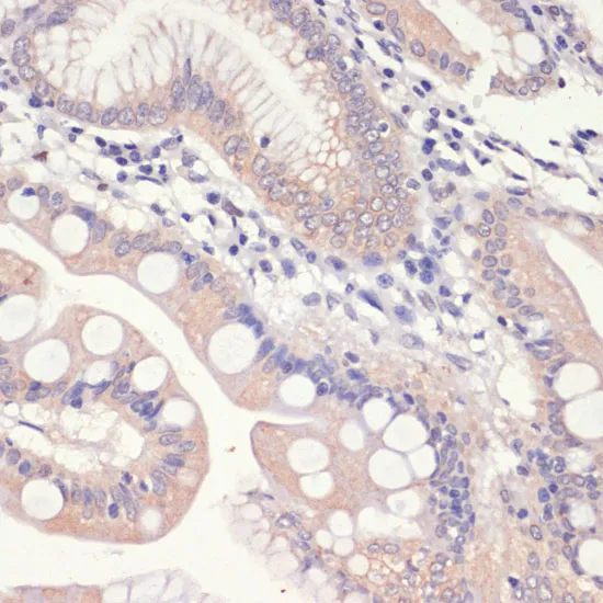 HMGCR Polyclonal Antibody - image 1