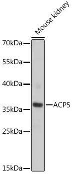 ACP5 Polyclonal Antibody - image 1