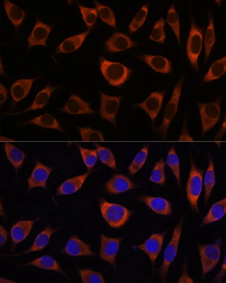 CTNNA3 Polyclonal Antibody - image 1