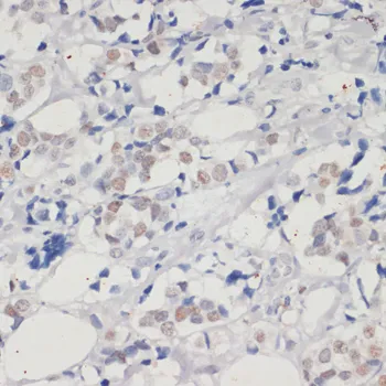 (KO Validated) DNMT1 Polyclonal Antibody - image 1