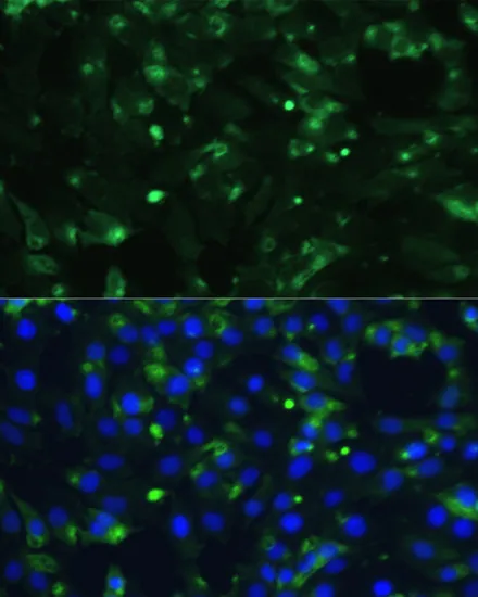 ENO1 Polyclonal Antibody - image 1