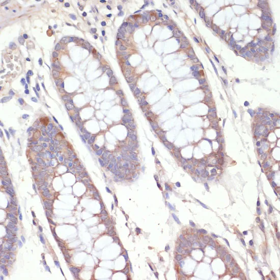 HMGCR Polyclonal Antibody - image 1