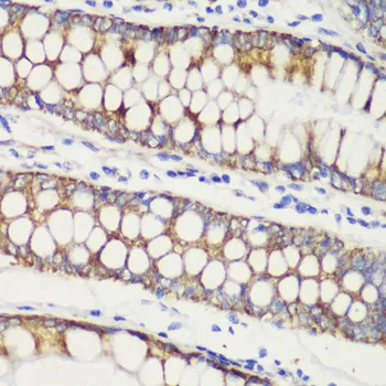 (KO Validated) TOM20 Polyclonal Antibody - image 1