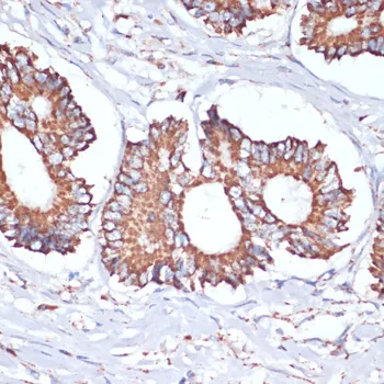 UBE2O Polyclonal Antibody - image 1