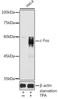c-Fos Polyclonal Antibody - image 1