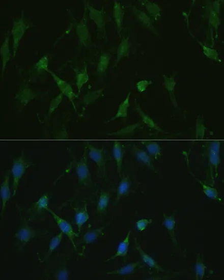 TRPV1 Polyclonal Antibody - image 1