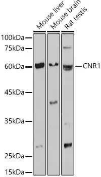 CNR1 Polyclonal Antibody - image 1