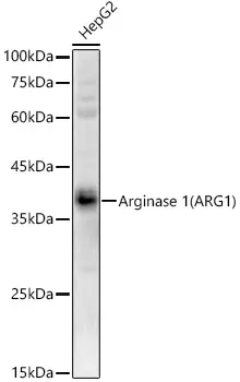 ARG1 / Arginase 1 Polyclonal Antibody - image 1