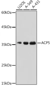 ACP5 Polyclonal Antibody - image 1