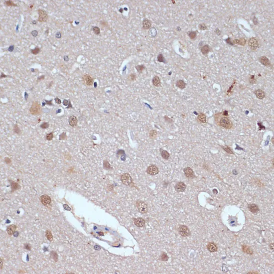 TP53BP2 Polyclonal Antibody - image 1