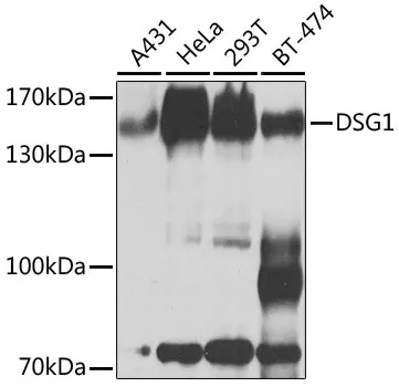 DSG1 Polyclonal Antibody - image 1