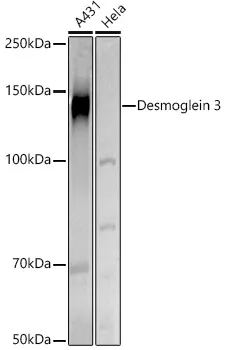 DSG3 Polyclonal Antibody - image 1