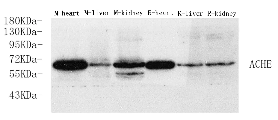 ACHE Polyclonal Antibody - image 1