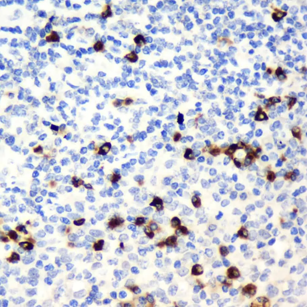CD19 Polyclonal Antibody - image 1