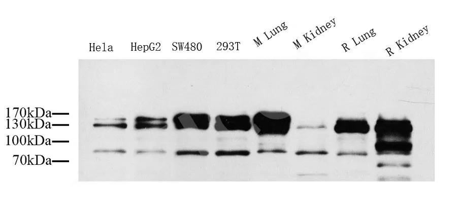 CD31 Polyclonal Antibody - image 1