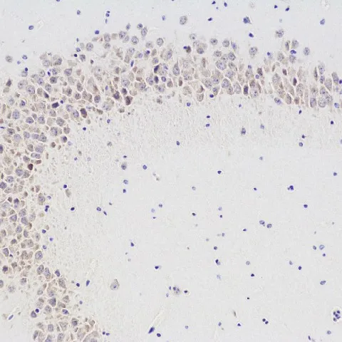 CHAT Polyclonal Antibody - image 1