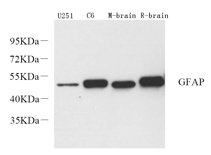 GFAP Polyclonal Antibody - image 1