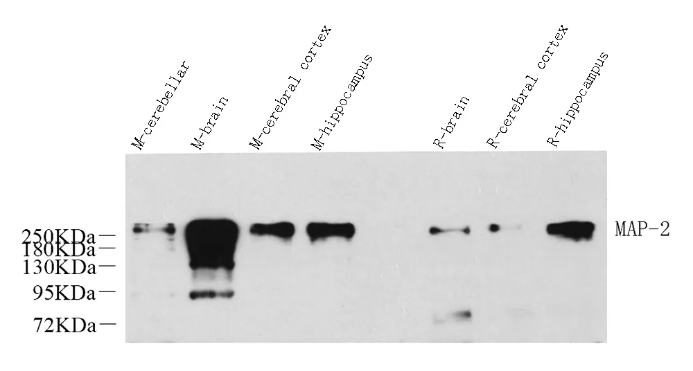 MAP2 Polyclonal Antibody - image 1