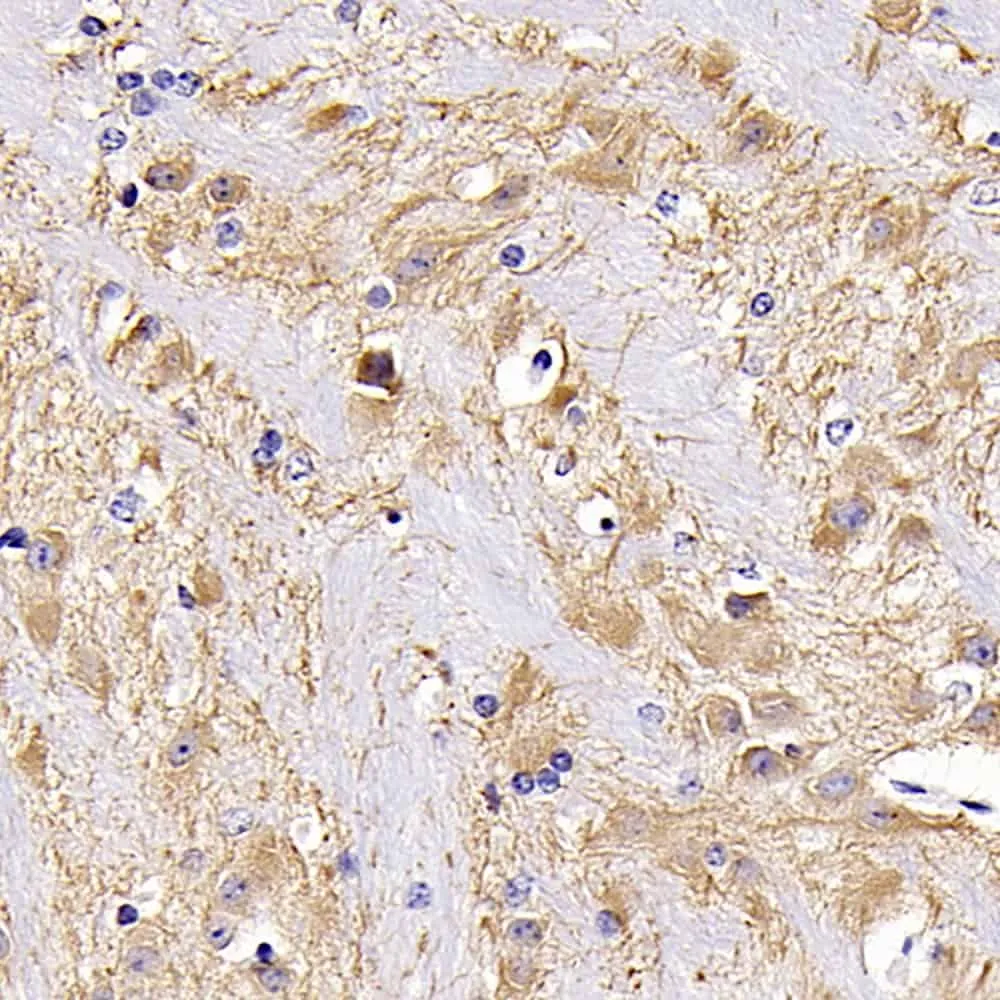 MAP2 Polyclonal Antibody - image 1