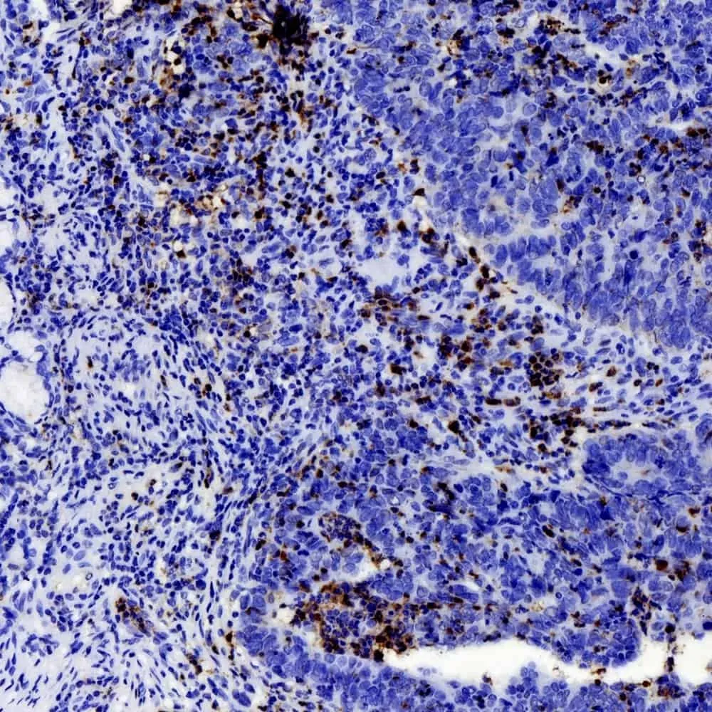 MMP9 Polyclonal Antibody - image 1