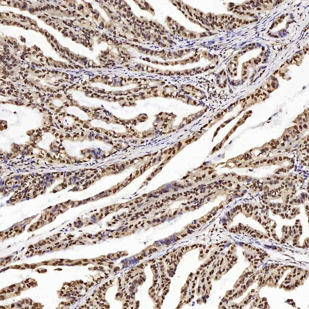 PTEN Polyclonal Antibody - image 1