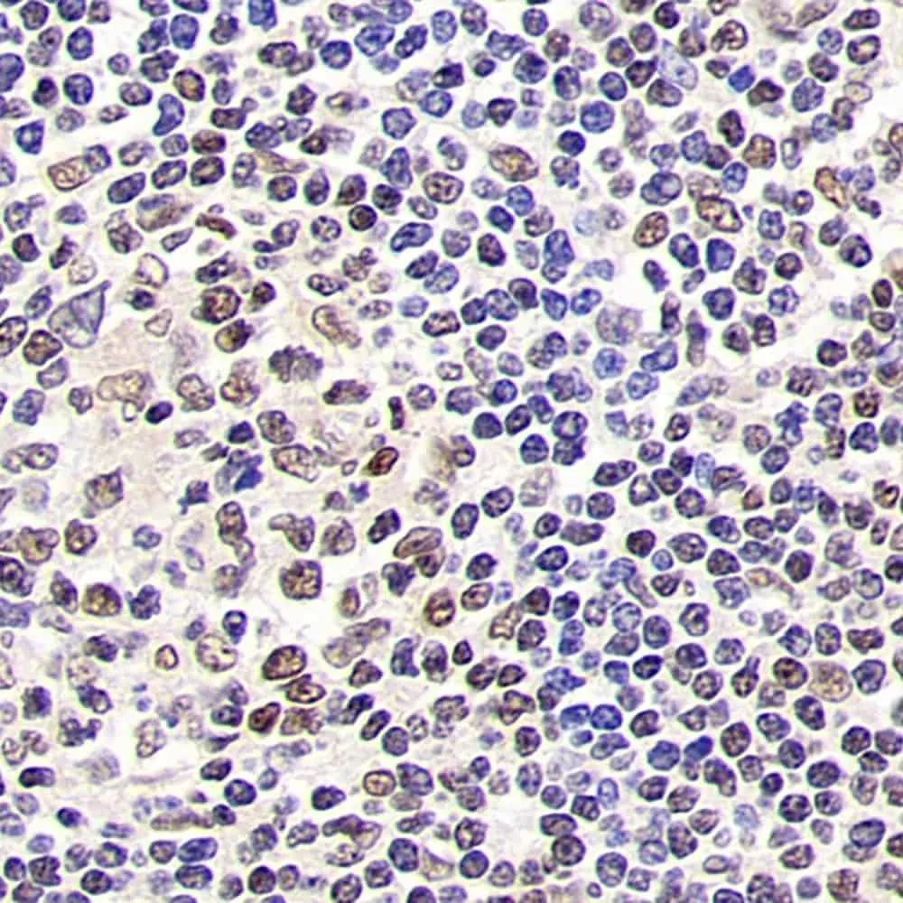 SIRT1 Polyclonal Antibody - image 1