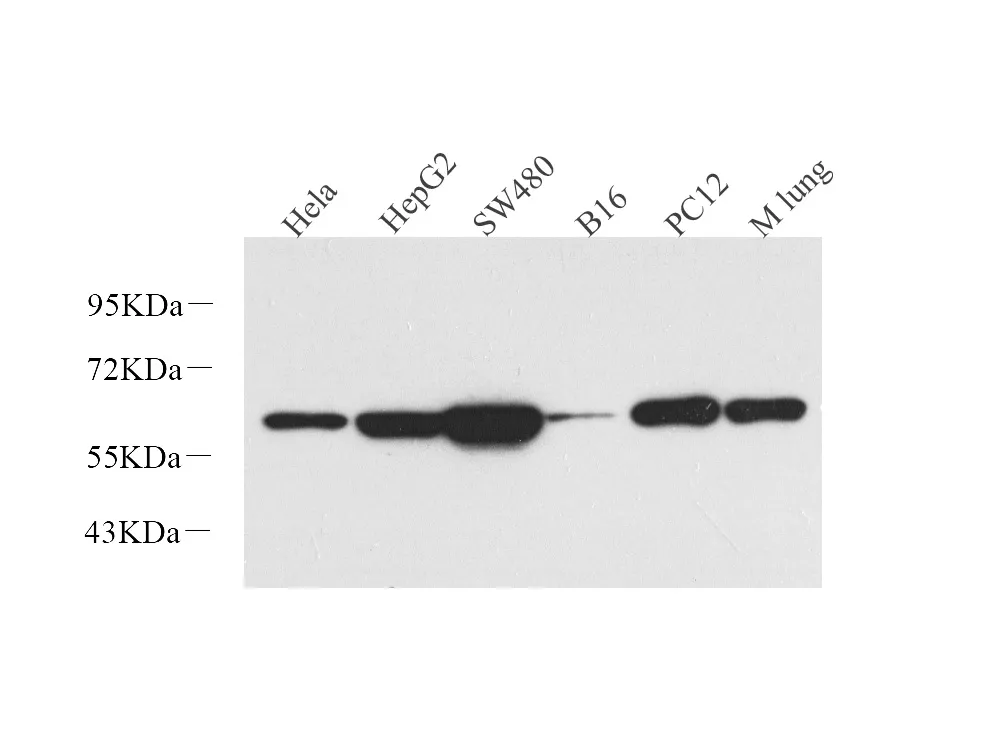Vimentin Polyclonal Antibody - image 1
