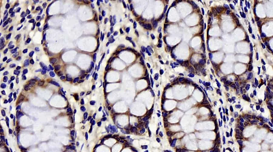 CHOP Polyclonal Antibody - image 1
