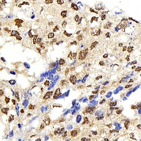 IkB alpha Polyclonal Antibody - image 1