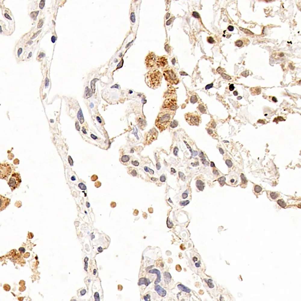 CXCR7 Polyclonal Antibody - image 1