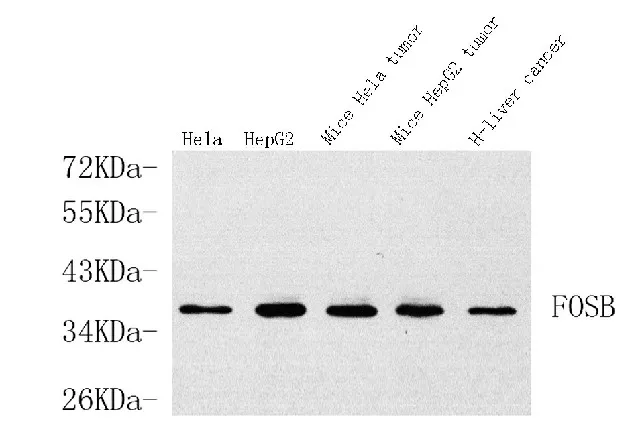 FOSB Polyclonal Antibody - image 1