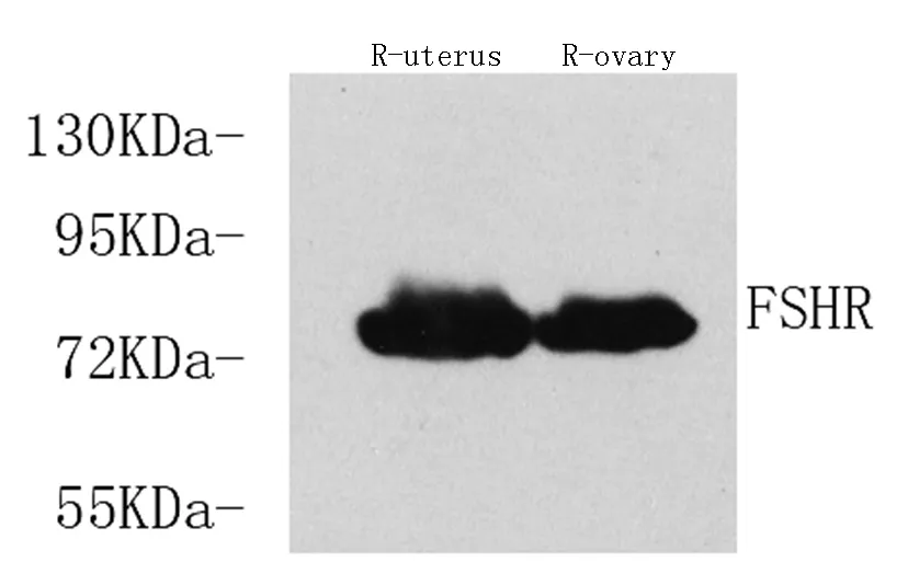 FSHR Polyclonal Antibody - image 1
