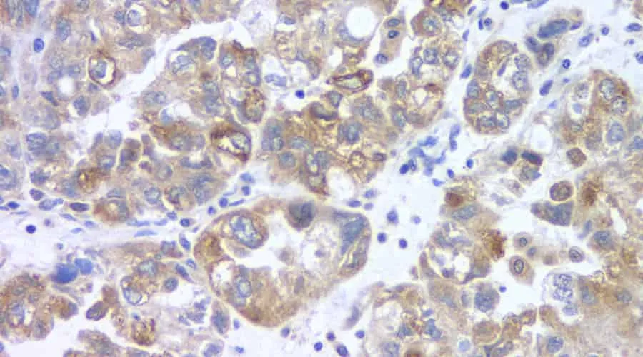 FSHR Polyclonal Antibody - image 1