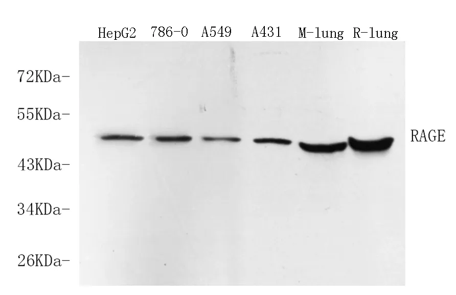 RAGE Polyclonal Antibody - image 1