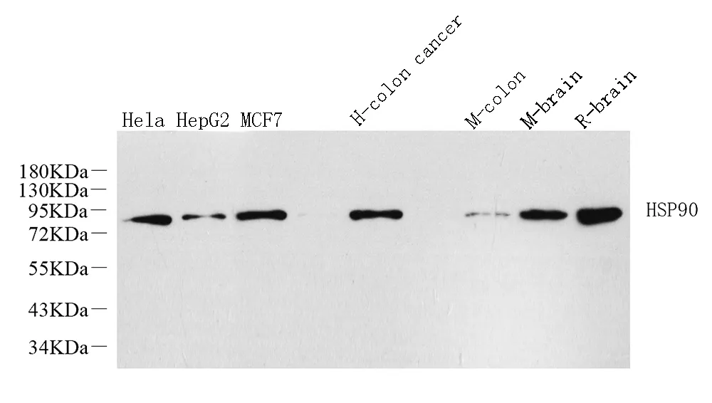 HSP90 alpha Polyclonal Antibody - image 1