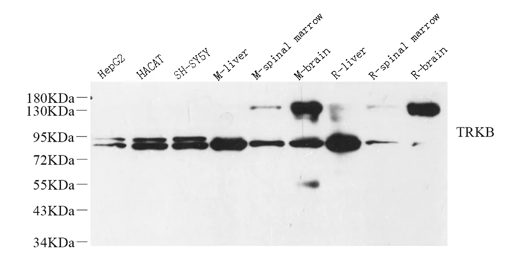 NTRK2 Polyclonal Antibody - image 1