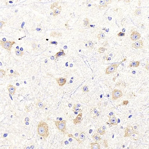 NTRK2 Polyclonal Antibody - image 1