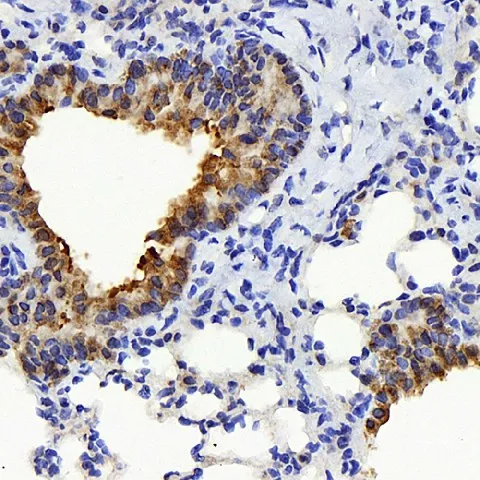 TSC22D3 Polyclonal Antibody - image 1