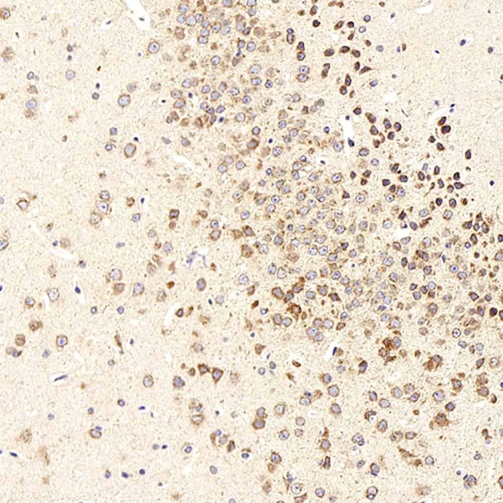 beta Amyloid Polyclonal Antibody - image 1